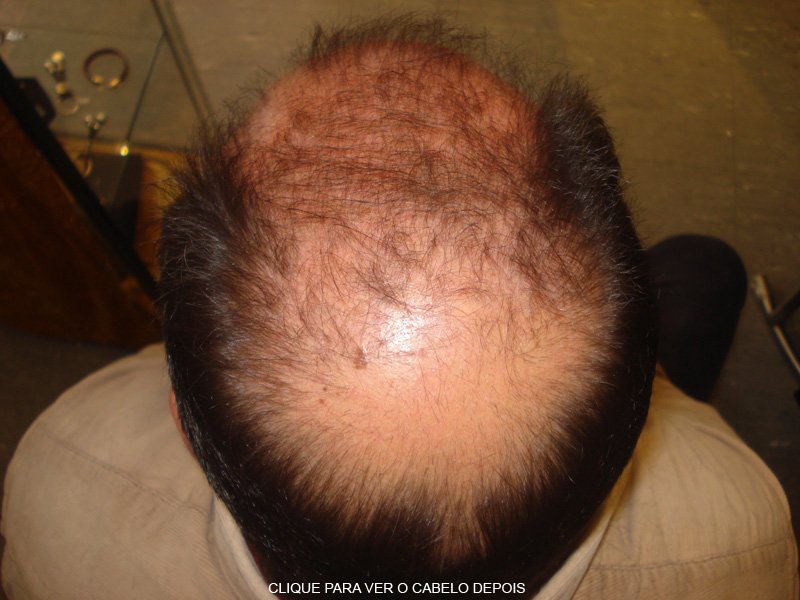Cabelo Antes